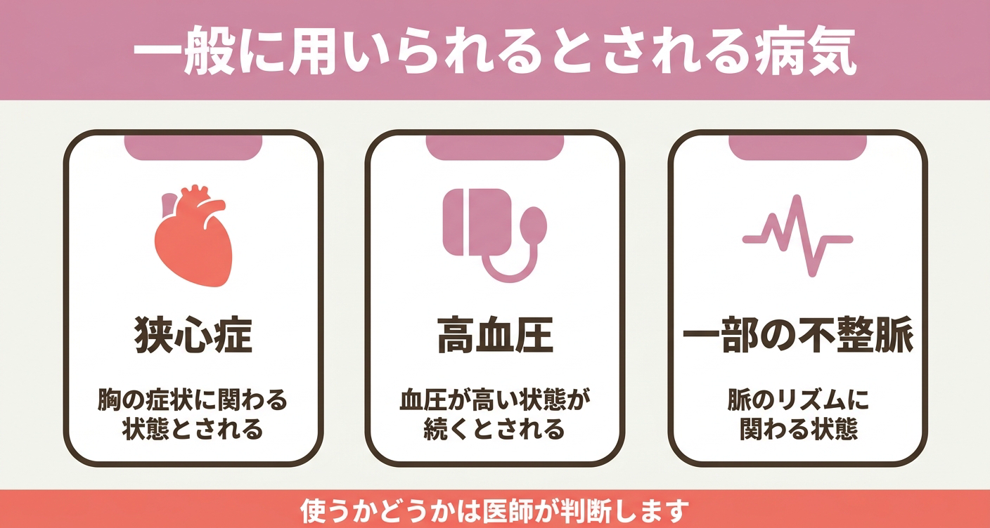 ジルチアゼムが一般に関連づけて語られる病気を「狭心症」「高血圧」「一部の不整脈」の3カードで整理した図解。あくまで選択肢の一つとして挙げられることを示し、使うかどうかは医師が判断する旨を添えて自己判断を避けるよう促します。