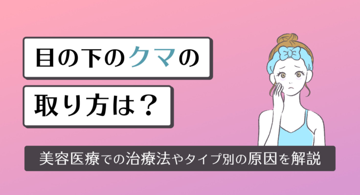 目の下のクマの取り方は？美容医療での治療法やタイプ別の原因を解説