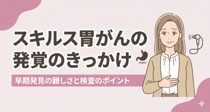 スキルス胃がんの発覚のきっかけ 早期発見の難しさと検査のポイント